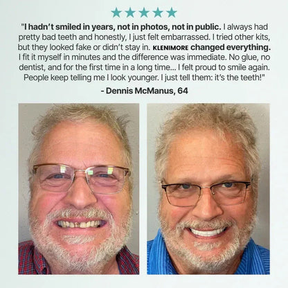 🌎Ends Today: 70% OFF! ⏰KLENIMORE™ Medical Full Denture with Strong Suction