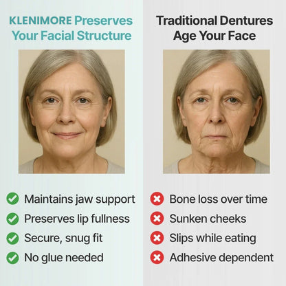 🌎Ends Today: 70% OFF! ⏰KLENIMORE™ Medical Full Denture with Strong Suction
